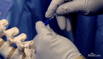 Interventional Pain Workshop: Coudé® Blunt Needle