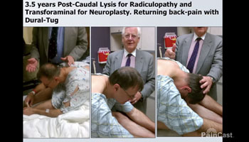 Dr. Racz Lectures on Lysis of Adhesions