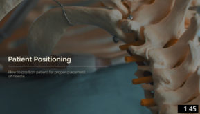 RX-2 Patient Positioning