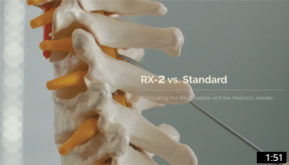 RX-2 vs Standard