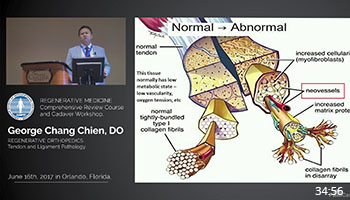 Regenerative Orthopedics Tendon and Ligament Pathology