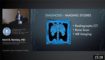 Imaging Evaluation of Vertebral Compression Fractures