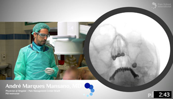 Trigeminal Lab RF Ganglion