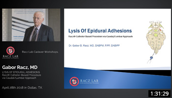 Lysis of Epidural Adhesions