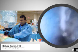 Endoscopic Discectomy