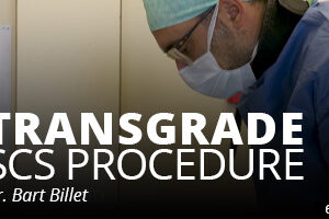 Transgrade SCS Procedure