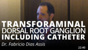 Fabricio Dias Assis_Transforaminal DRG
