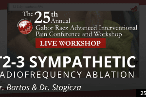 Bartos x Stogicza - T2-3 Sympathetic RFA