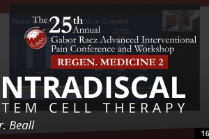Beall – Intradiscal Stem Cell Therapy