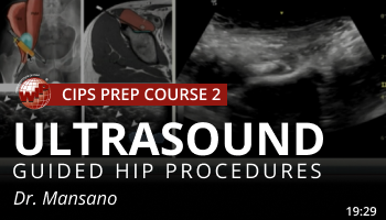 Mansano – Epidural Transforaminal Techniques – Is there any Differences