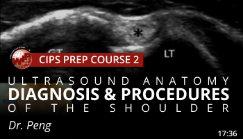 Peng – Ultrasound Anatomy, Diagnoses and Procedures of the Shoulder