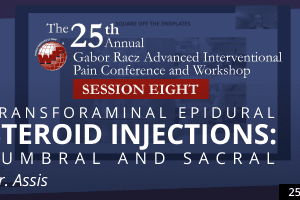 Dias Assis - Transforaminal Epidural Steroid Injection - Lumbar and Sacral