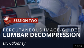 Calodney – Percutaneous Image-Guided Lumbar Decompression