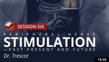 Trescot – Peripheral Nerve Stimulation – Past Present and Future
