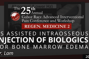 Lam - US Assisted Intraosseous Injection of Biologics for Bone Marrow Edema