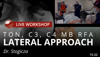 Stogicza – TON, C3, C4 MB RFA Lateral Approach