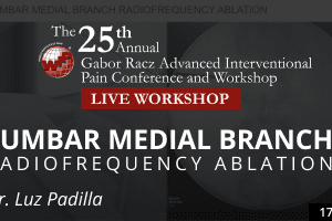 Luz Padilla - Lumbar Medial Branch Radiofrequency Ablation