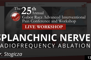 Stogicza - Splanchnic Nerve Radiofrequency Ablation