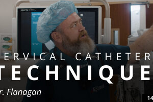 Cervical Catheter Technique