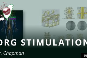 Dorsal Root Ganglion Stimulation