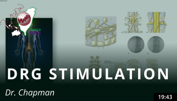 Dorsal Root Ganglion Stimulation