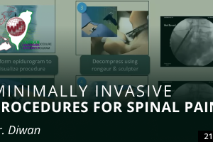 Minimally Invasive Procedures for Spinal Pain