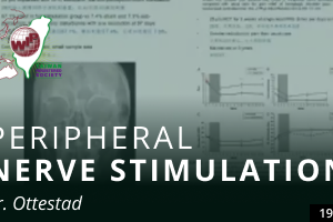 Peripheral Nerve Stimulation