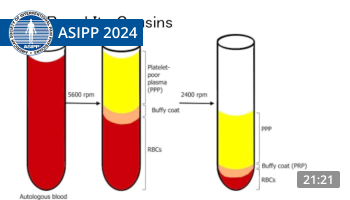 Calodney – Regenerative Medicine